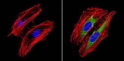 Invitrogen RhoA/RhoC Monoclonal Antibody (1B3-4A10) 100 &mu;g; Unconjugated:Antibodies,