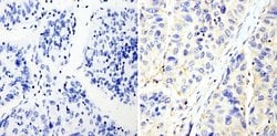 Invitrogen RhoA/RhoC Monoclonal Antibody (1B3-4A10) 100 &mu;g; Unconjugated:Antibodies,