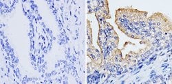 Invitrogen RhoA/RhoC Monoclonal Antibody (1B3-4A10) 100 &mu;g; Unconjugated:Antibodies,
