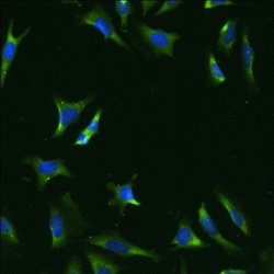 Invitrogen rRNA Monoclonal Antibody (Y10b) 100 &mu;g; Unconjugated:Antibodies,