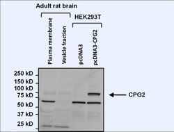 Invitrogen Nesprin 1 Monoclonal Antibody (6A) 100 &mu;g; Unconjugated:Antibodies,