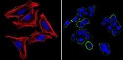 Invitrogen™ SSEA5 Monoclonal Antibody (8E11), DyLight™ 488