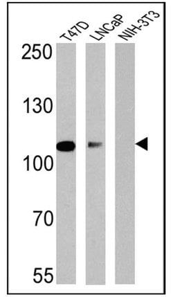 Invitrogen Androgen Receptor Monoclonal Antibody (AN1-15) 50 &mu;g; Unconjugated:Antibodies,