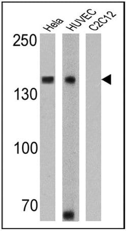 Invitrogen N-cadherin Monoclonal Antibody (8C11) 100 &mu;g; Unconjugated:Antibodies,