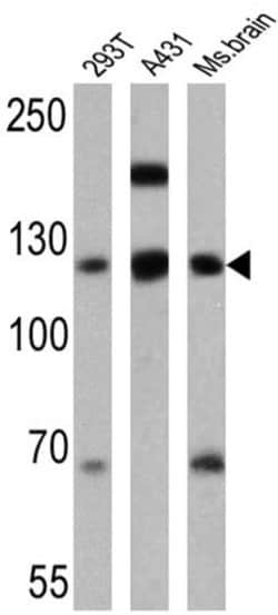Invitrogen P-cadherin Monoclonal Antibody (6A9) 100 &mu;g; Unconjugated:Antibodies,