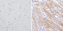 Invitrogen NEFM Monoclonal Antibody (3H11) 100 μg; Unconjugated:Antibodies,