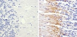 Invitrogen NEFM Monoclonal Antibody (3H11) 100 μg; Unconjugated:Antibodies,