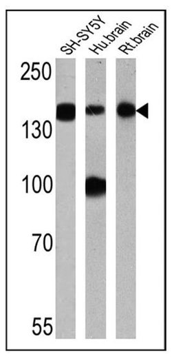 Invitrogen NEFM Monoclonal Antibody (3H11) 100 μg; Unconjugated:Antibodies,
