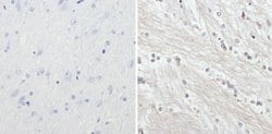 Invitrogen NF-H Monoclonal Antibody (3G3) 100 &mu;g; Unconjugated:Antibodies,
