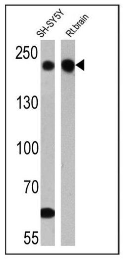 Invitrogen NF-H Monoclonal Antibody (3G3) 100 &mu;g; Unconjugated:Antibodies,