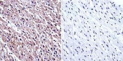 Invitrogen GRK2 Monoclonal Antibody (5D5) 100 &mu;g; Unconjugated:Antibodies,