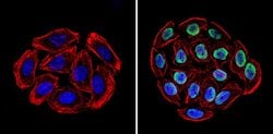 Ku70/Ku80 Monoclonal Antibody (162), Invitrogen 500 &mu;L; Unconjugated:Antibodies,