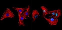 Ku70/Ku80 Monoclonal Antibody (162), Invitrogen 500 &mu;L; Unconjugated:Antibodies,