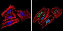 Ku70/Ku80 Monoclonal Antibody (162), Invitrogen 500 &mu;L; Unconjugated:Antibodies,