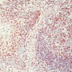 Ku70/Ku80 Monoclonal Antibody (162), Invitrogen 500 &mu;L; Unconjugated:Antibodies,