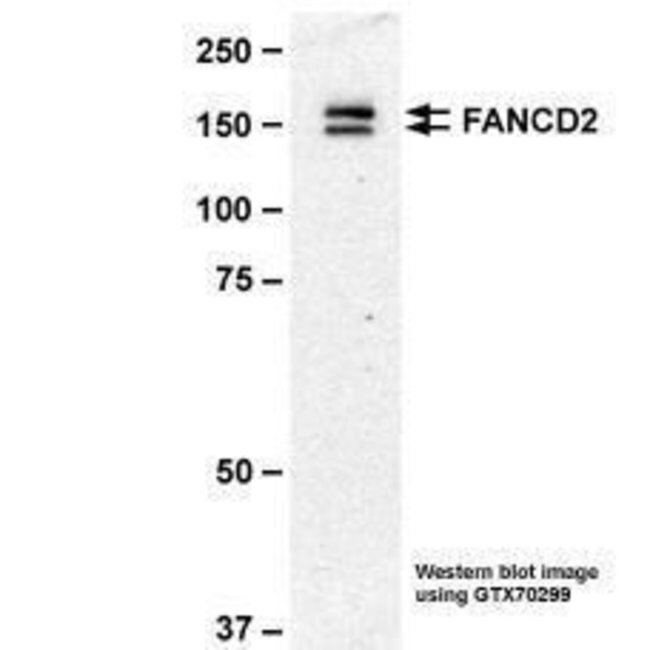 Invitrogen FANCD2 Monoclonal Antibody (103), Invitrogen™ 100 μg