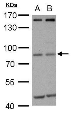 MDM2 Mouse anti-Human, Clone: 2A10, Invitrogen 50 &mu;g; Unconjugated:Antibodies,