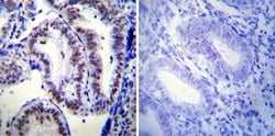 Invitrogen Progesterone Receptor Monoclonal Antibody (PR-AT 4.14) 100 &mu;g;
