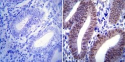 Invitrogen Progesterone Receptor Monoclonal Antibody (Alpha PR6) 100 &mu;g;