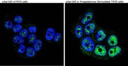 Invitrogen Phospho-Progesterone Receptor (Ser190) Monoclonal Antibody (1154)