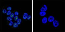 Invitrogen Phospho-Progesterone Receptor (Ser190) Monoclonal Antibody (1154)