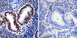 Invitrogen Phospho-Progesterone Receptor (Ser190) Monoclonal Antibody (1154)