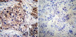 Invitrogen Phospho-Progesterone Receptor (Ser190) Monoclonal Antibody (1154)