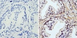 Invitrogen APE1 Monoclonal Antibody (13B 8E5C2) 100 &mu;L; Unconjugated:Antibodies,