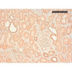 Invitrogen Cytokeratin Pan Type II Monoclonal Antibody (AE3) 200 &mu;L;