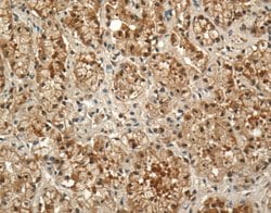 Invitrogen Prolactin Receptor Monoclonal Antibody (U5) 100 &mu;g; Unconjugated:Antibodies,
