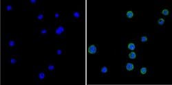 GRK1 Monoclonal Antibody (G8), Invitrogen 100 &mu;g; Unconjugated:Antibodies,