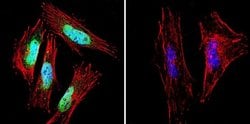 Invitrogen Presenilin 1 Monoclonal Antibody (APS 18) 200 &mu;g; Unconjugated:Antibodies,