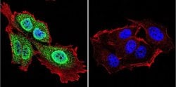 Invitrogen Presenilin 1 Monoclonal Antibody (APS 18) 200 &mu;g; Unconjugated:Antibodies,