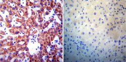 Invitrogen Presenilin 1 Monoclonal Antibody (APS 18) 200 &mu;g; Unconjugated:Antibodies,