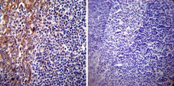 Invitrogen Presenilin 1 Monoclonal Antibody (APS 18) 200 &mu;g; Unconjugated:Antibodies,