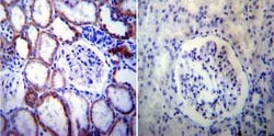 Invitrogen PSEN2 Monoclonal Antibody (APS 21) 200 &mu;g; Unconjugated:Antibodies,