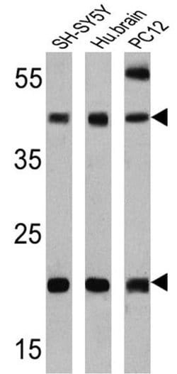 Invitrogen PSEN2 Monoclonal Antibody (APS 21) 200 &mu;g; Unconjugated:Antibodies,