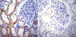 Invitrogen PSEN2 Monoclonal Antibody (APS 26) 200 &mu;g; Unconjugated:Antibodies,