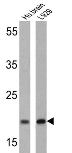 Invitrogen PSEN2 Monoclonal Antibody (APS 26) 200 &mu;g; Unconjugated:Antibodies,