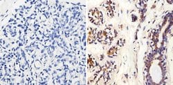 Invitrogen MMP2 Monoclonal Antibody (MMP2/2C1-1D12) 100 &mu;g; Unconjugated:Antibodies,