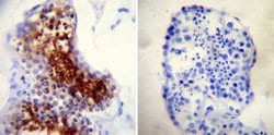 Invitrogen TPX2 Monoclonal Antibody (18D5-1) 100 &mu;g; Unconjugated:Antibodies,