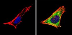 Invitrogen RARA Monoclonal Antibody (Ralpha10) 50 &mu;g; Unconjugated:Antibodies,