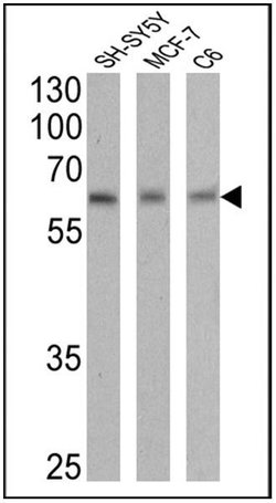 Invitrogen RARA Monoclonal Antibody (Ralpha10) 50 &mu;g; Unconjugated:Antibodies,