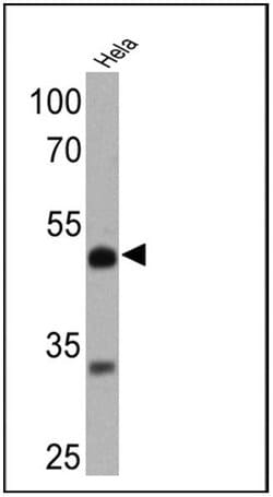 Invitrogen RARB Monoclonal Antibody (R beta 28) 50 &mu;g; Unconjugated:Antibodies,