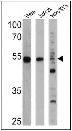 Invitrogen PPAR alpha Monoclonal Antibody (3B6/PPAR) 100 &mu;g; Unconjugated:Antibodies,
