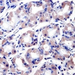 Invitrogen RANBP2 Monoclonal Antibody (2E1) 100 &mu;g; Unconjugated:Antibodies,