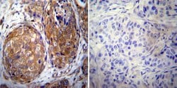 Invitrogen ErbB4 Monoclonal Antibody (HFR1) 200 &mu;g; Unconjugated:Antibodies,