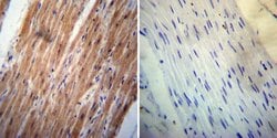 Invitrogen ErbB4 Monoclonal Antibody (HFR1) 200 &mu;g; Unconjugated:Antibodies,