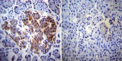 Invitrogen ErbB4 Monoclonal Antibody (HFR1) 200 &mu;g; Unconjugated:Antibodies,