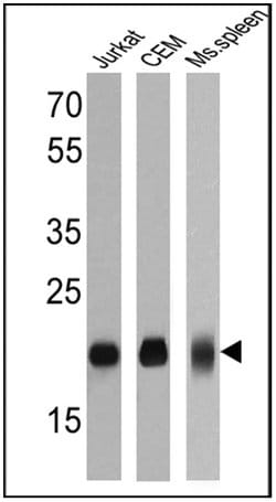 Invitrogen CD3e Monoclonal Antibody (SP7) 500 &mu;L; Unconjugated:Antibodies,
